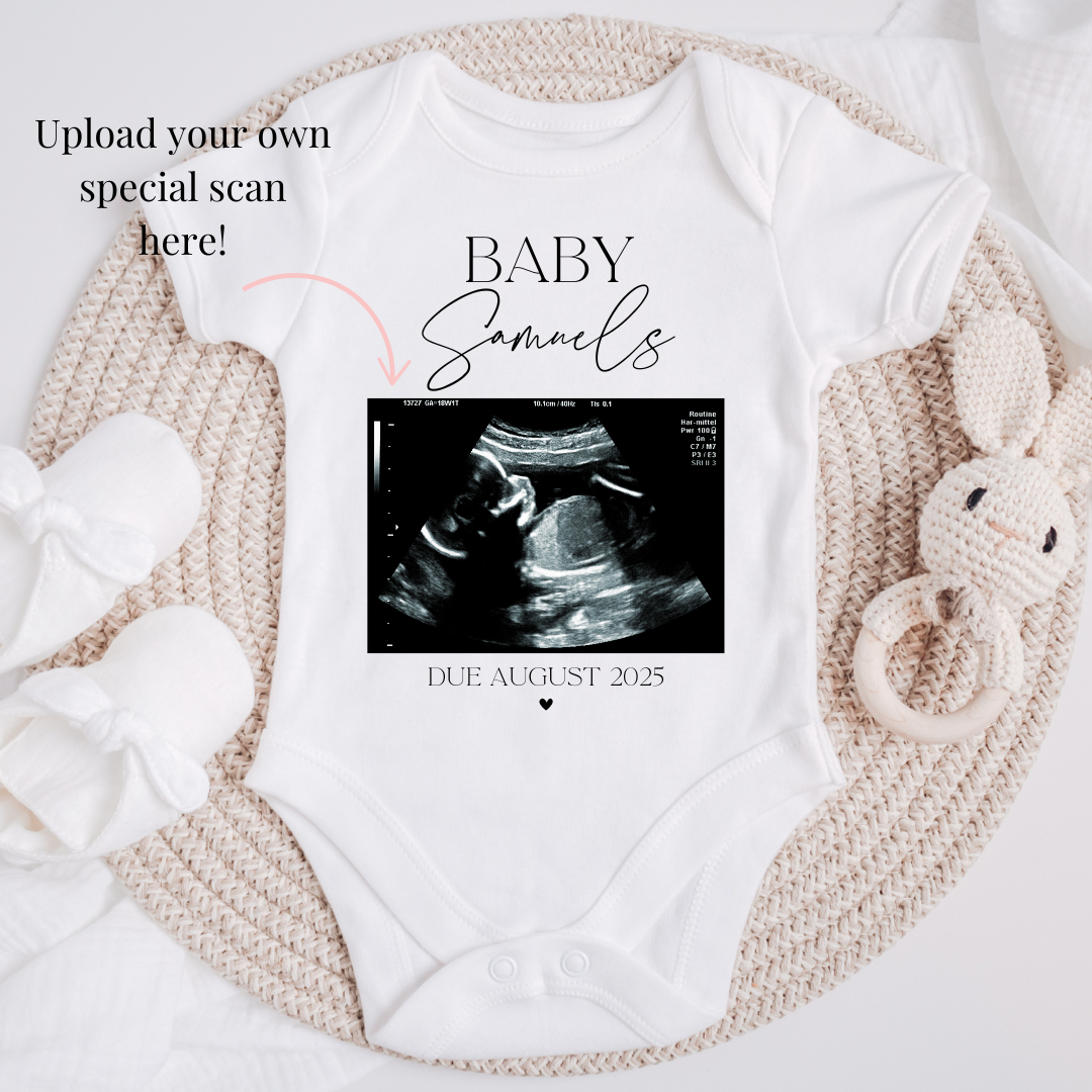 Ultrasound Scan Personalised Baby Grow Pregnancy Announcement Onesie
