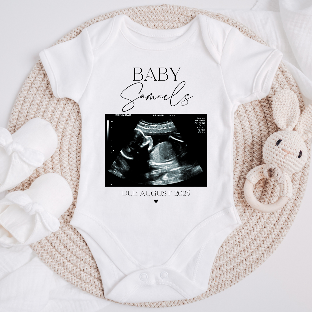 Ultrasound Scan Personalised Baby Grow Pregnancy Announcement